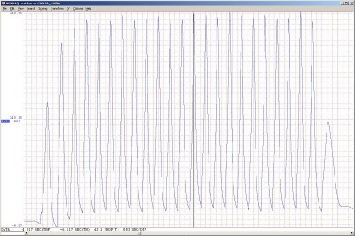 compressions rotor AV, après décalaminage